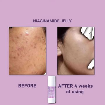 Niacinamide Jelly - Free Delivery