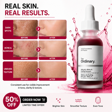 The Ordinary Peeling Solution – Advanced Exfoliating Peel for Brighter Skin – Exfoliates Dead Skin, Brightens & Evens Tone, Clears Pores & Smooths Skin – For Dark Spots, Acne, Black Elbows & Uneven Texture