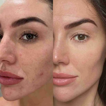 VT Cosmetics PDRN Essence Stick Balm | 1-Second Glow with Plant-Based PDRN, Collagen & Ceramide | Wrinkle Care, Instant Hydration & Flawless Makeup Base