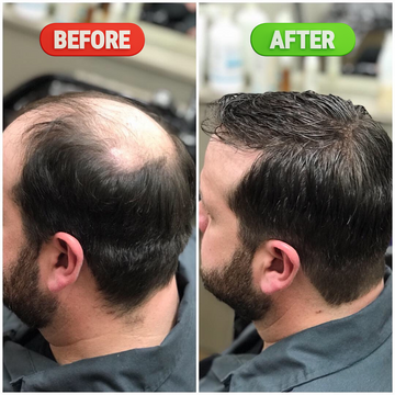 Bare Anatomy Nature x Science Rosemary Water Spray